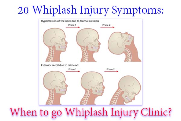 Whiplash injury symptoms When to go Whiplash injury clinic