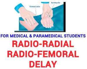 radio femoral delay
