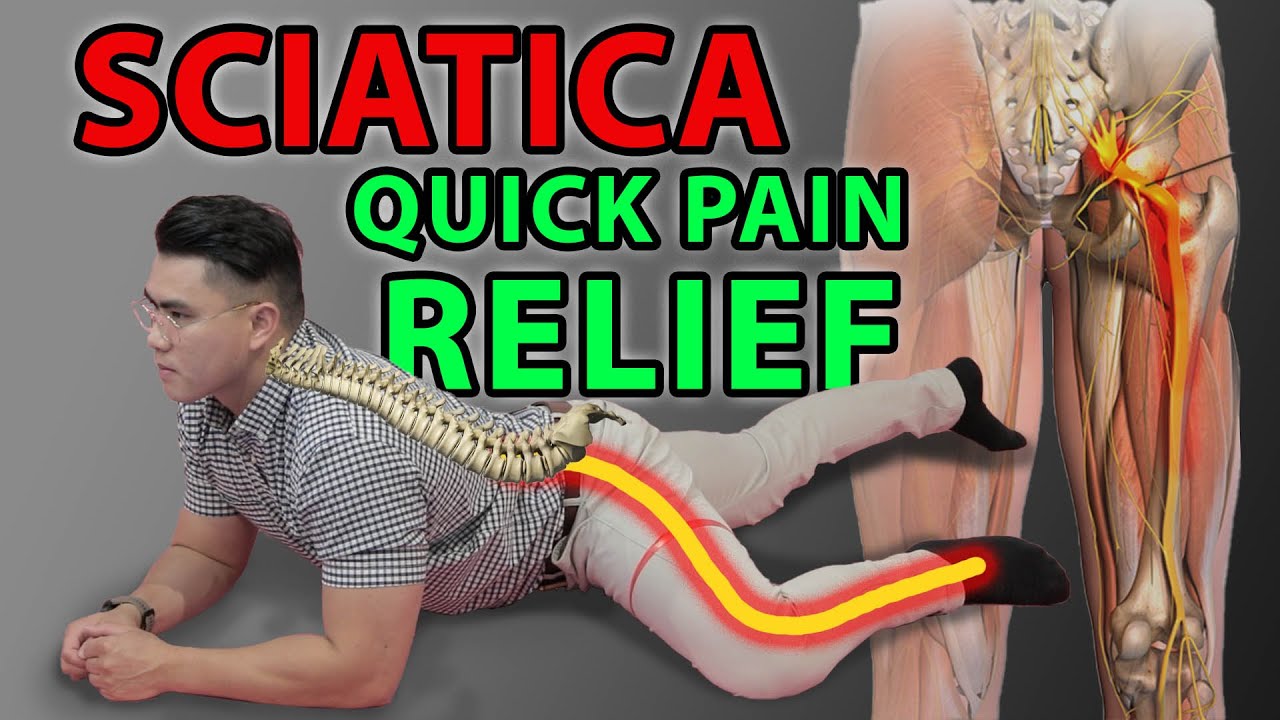 5 Best Sciatica Exercises for Leg Pain Videos You should Know