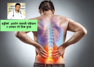 bone tb dr.saroj k suwal