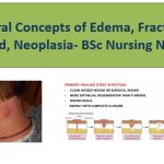 General Concepts of Edema, Fracture, wound, Neoplasia- BSc Nursing Notes