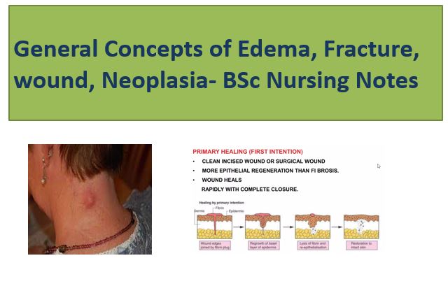 General Concepts of Edema, Fracture, wound, Neoplasia- BSc Nursing Notes