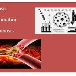 Necrosis, Inflammation, Thrombosis- BSc Pathophysiology Nursing Notes