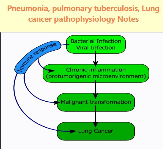 pneumonia, pulmonary tuberculosis, Lung cancer pathophysiology Notes