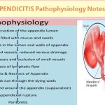 APPENDICITIS Pathophysiology