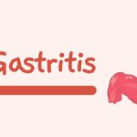 GASTRITIS Pathophysiology Nursing Notes
