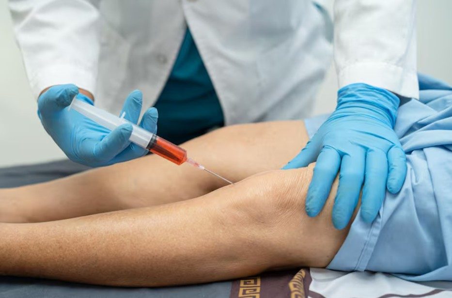 Dr. Suwal performing Platelet-Rich Plasma injection for knee joint osteoarthritis